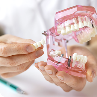 インプラント【安心の永続的解決法】